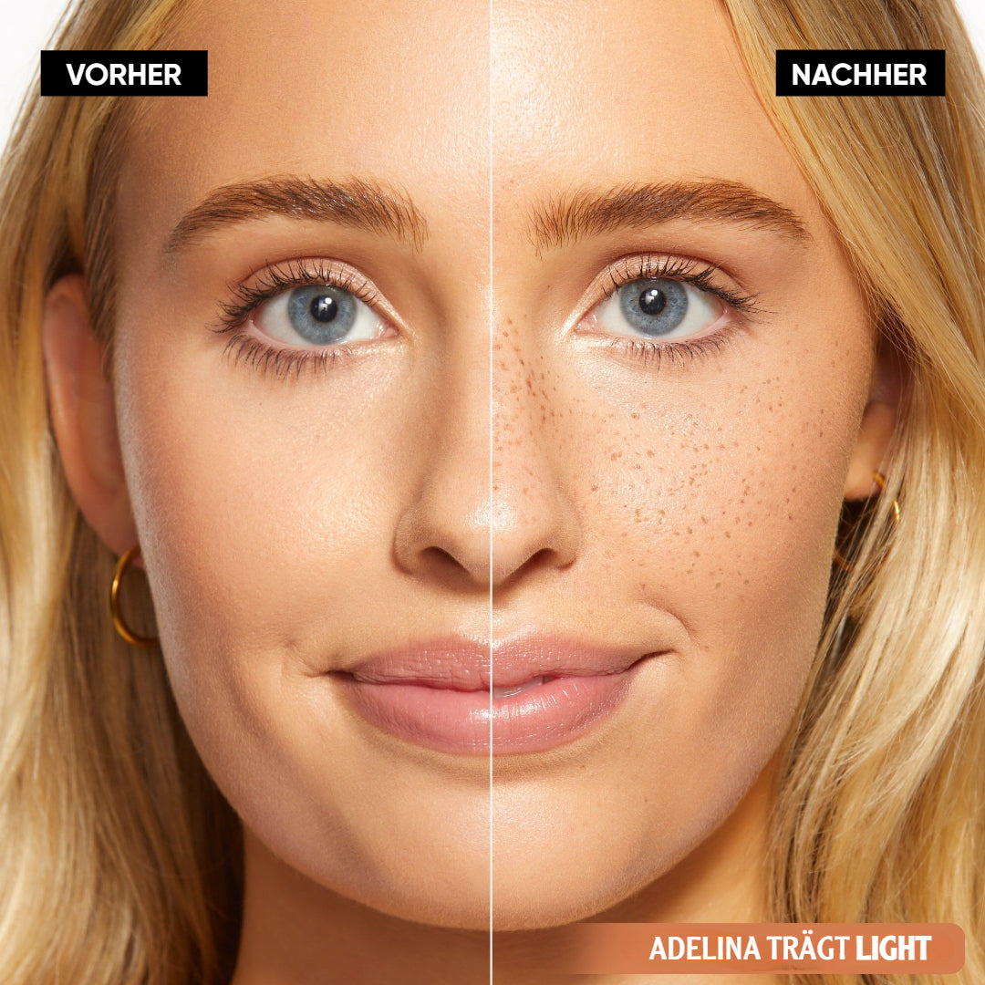 SpeckleTouch™ – Verspielter & auffälliger Beauty-Akzent [50 % Rabatt]