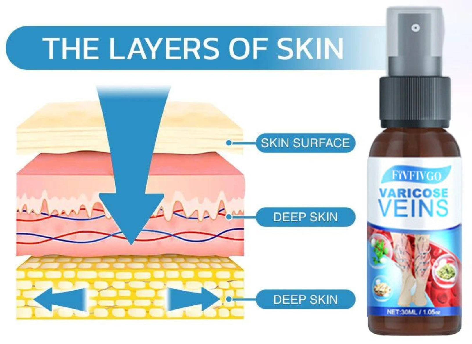 VariCose™ – Effektives Krampfader-Spray für schnelle Linderung und gesunde Beine [1 + 1 Gratis]