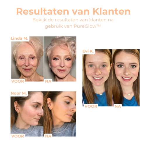 PureGlow™ - Straffende Schönheitscreme für sichtbar glattere Haut [50% Rabatt]