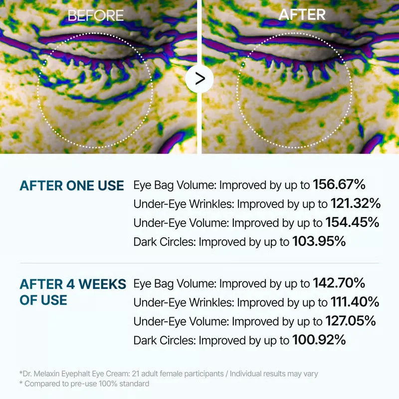 FirmEye™ – Erfrischt müde Augen und enthüllt strahlenden, jugendlichen Glanz [1 + 1 Gratis]