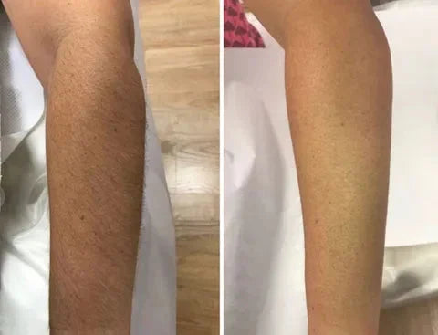 SoftSilk™ – Lang anhaltend glatte Haut & sicheres Gefühl [50 % Rabatt]