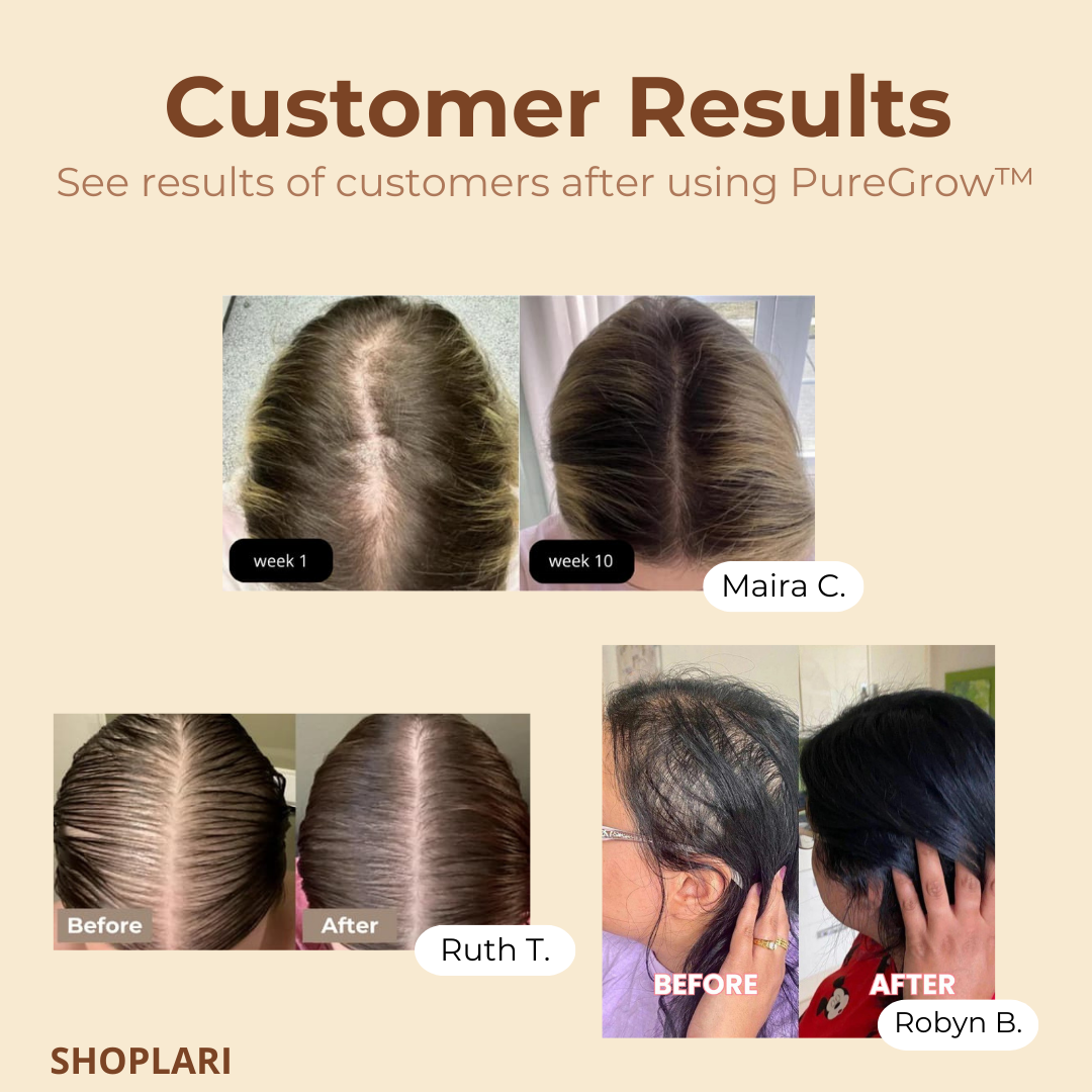 PureGrow™ – Intensive Kopfhautpflege für gesundes Haar [50 % Rabatt]