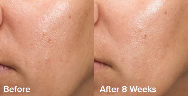 GlowEssence™ – Das einzige Peeling-Gel, das Sie für glatte & strahlende Haut brauchen [50 % Rabatt]
