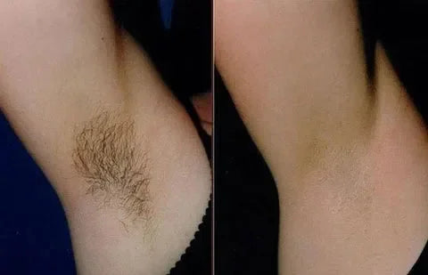 SoftSilk™ – Lang anhaltend glatte Haut & sicheres Gefühl [50 % Rabatt]
