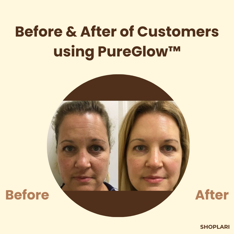 PureGlow™ – Klare, jugendliche Haut, die Selbstvertrauen ausstrahlt [1 + 1 Gratis]