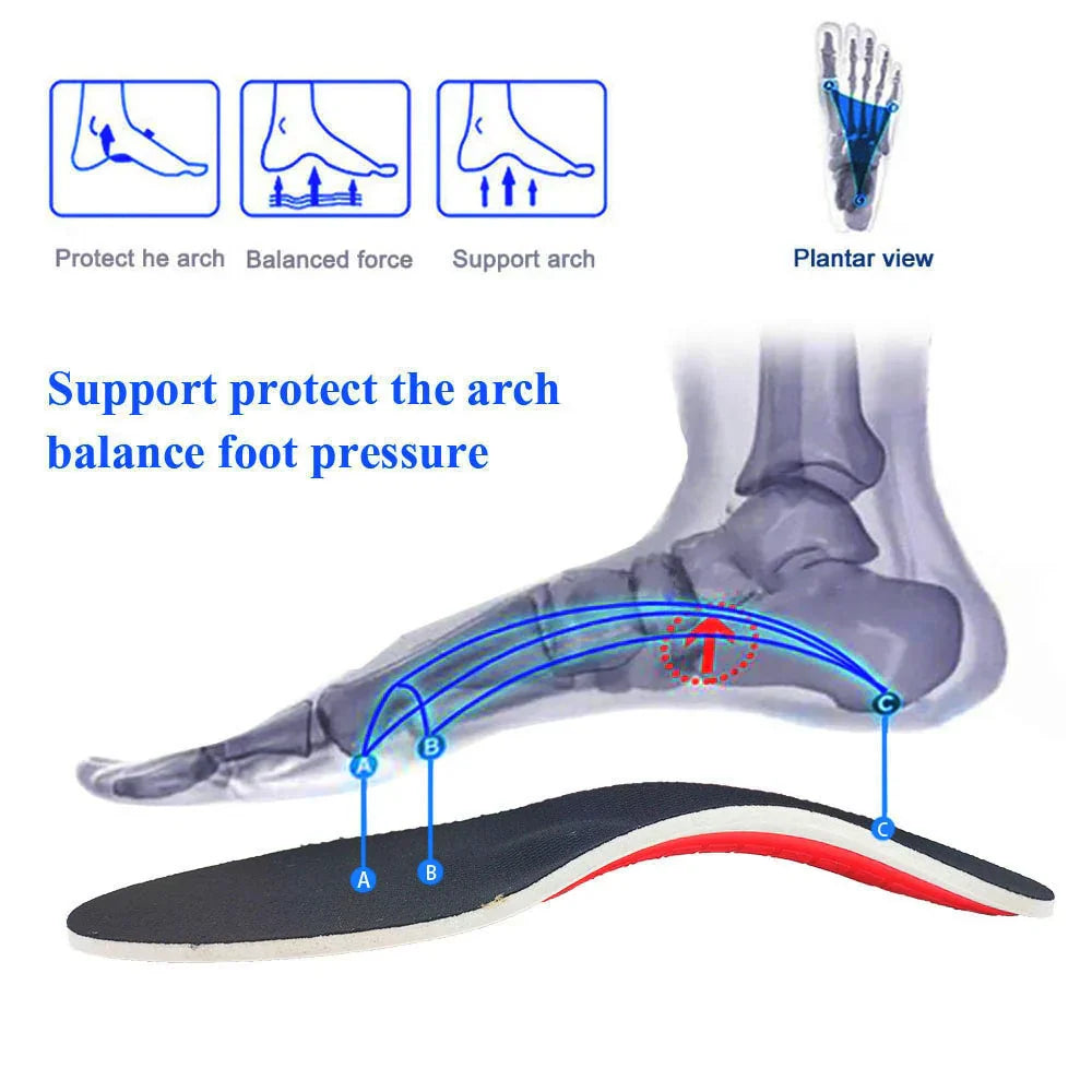 ArchEase™ - Orthopädische Einlegesohle [1 + 1 Gratis]