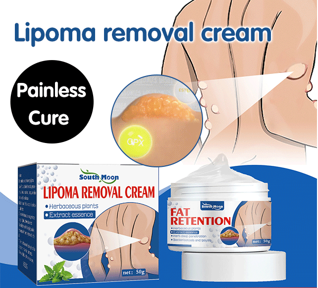 LipoGone Lipom Creme – Schmerzfrei, Natürlich, Entzündungshemmend, Effektiv, Hautpflege