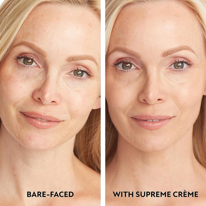 MoistureLuxe™ - Feuchtigkeitsspendender Concealer mit natürlicher Deckkraft [1 + 1 Gratis]
