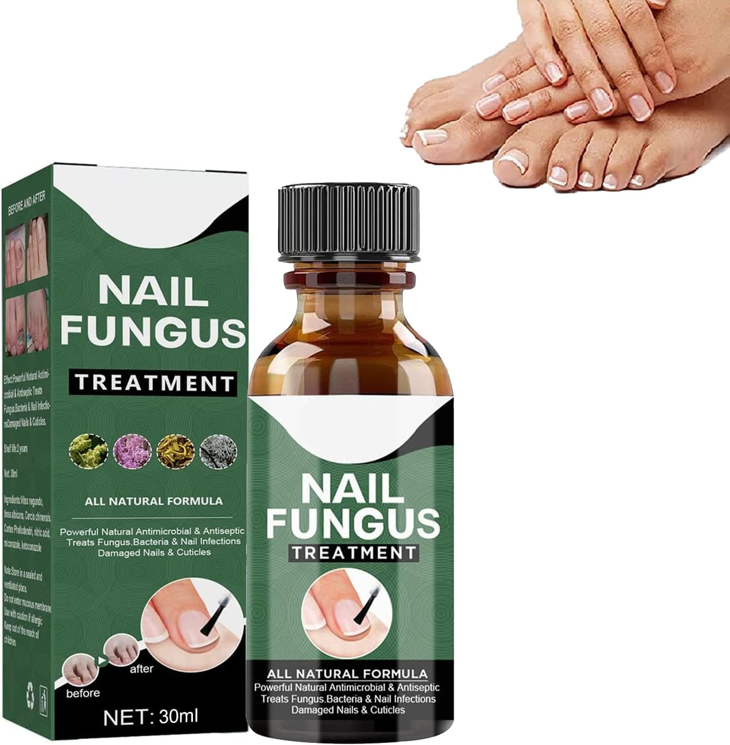 NagelPilz™ – Heilt, regeneriert & schützt geschädigte Nägel [1 + 1 Gratis]