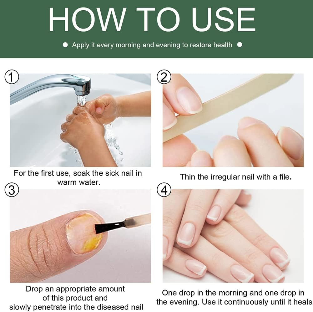 NagelPilz™ – Heilt, regeneriert & schützt geschädigte Nägel [1 + 1 Gratis]