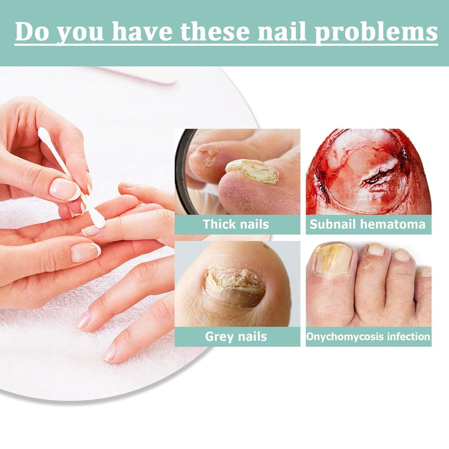 VitaNail™ - Natürlicher Nagelpflege-Stick | Für gesündere, Glänzende Nägel [1 + 1 Gratis]