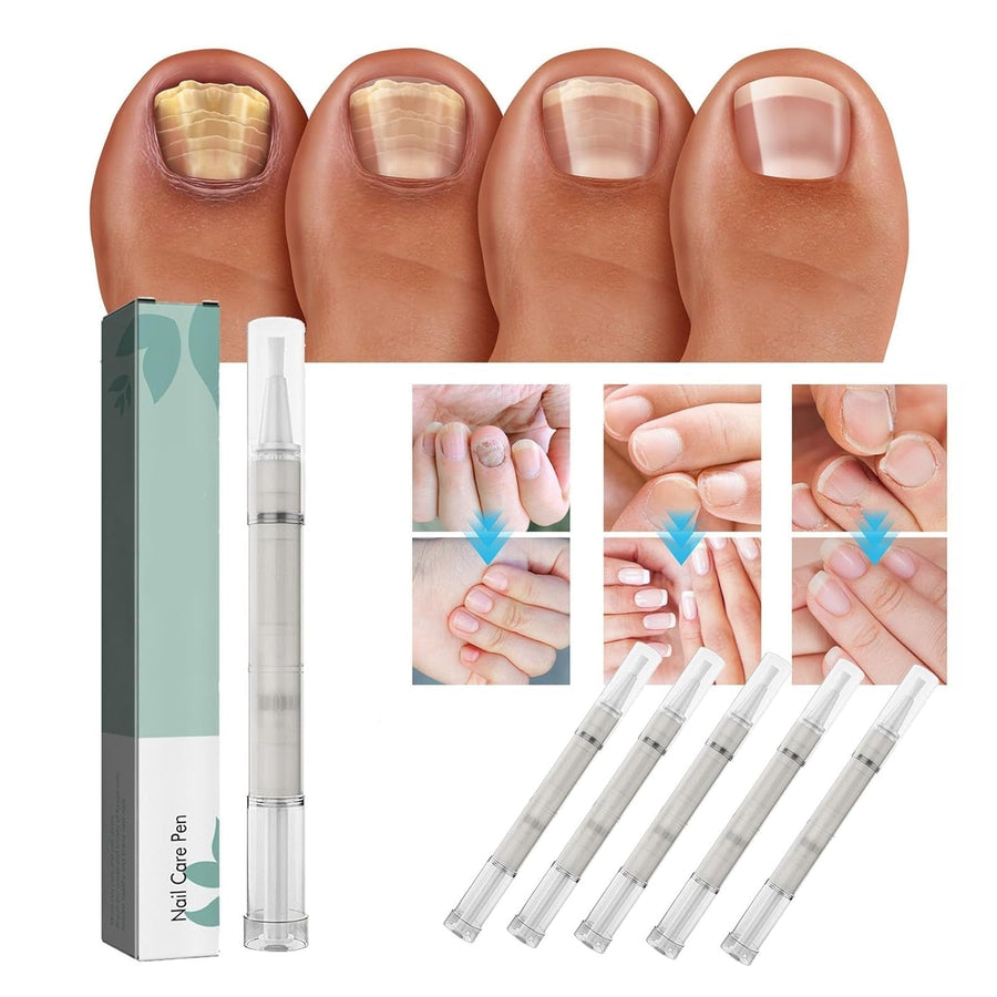 NailBloom Nagelpflege-Stick – Natürlicher, stärkender Pflege-Stick mit Teebaumöl und Vitamin E für Hände und Füße