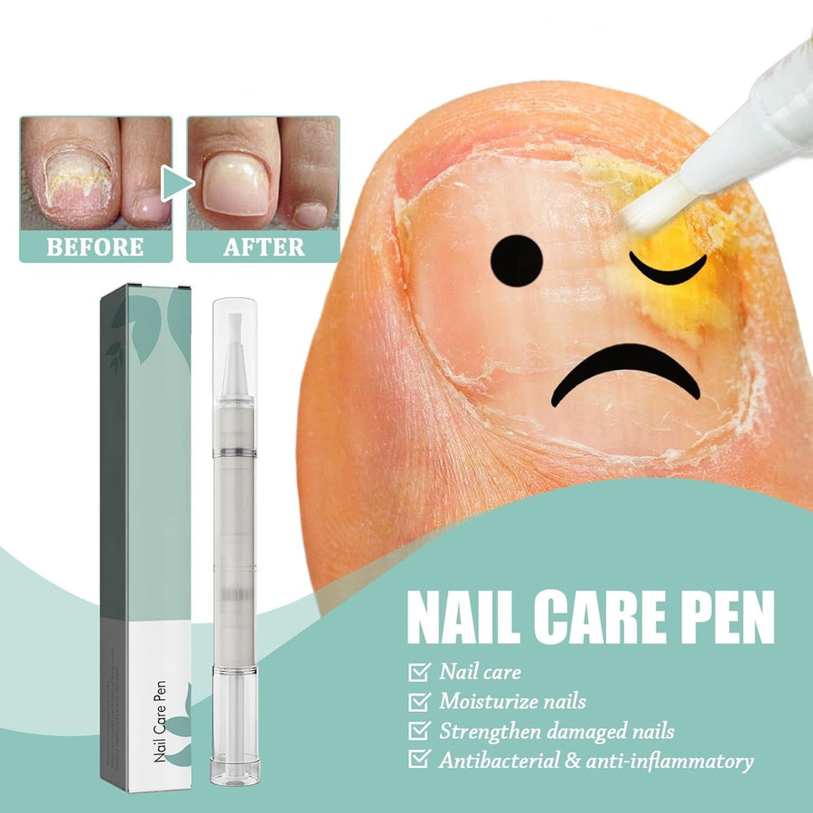 VitaNail™ - Natürlicher Nagelpflege-Stick | Für gesündere, Glänzende Nägel [1 + 1 Gratis]
