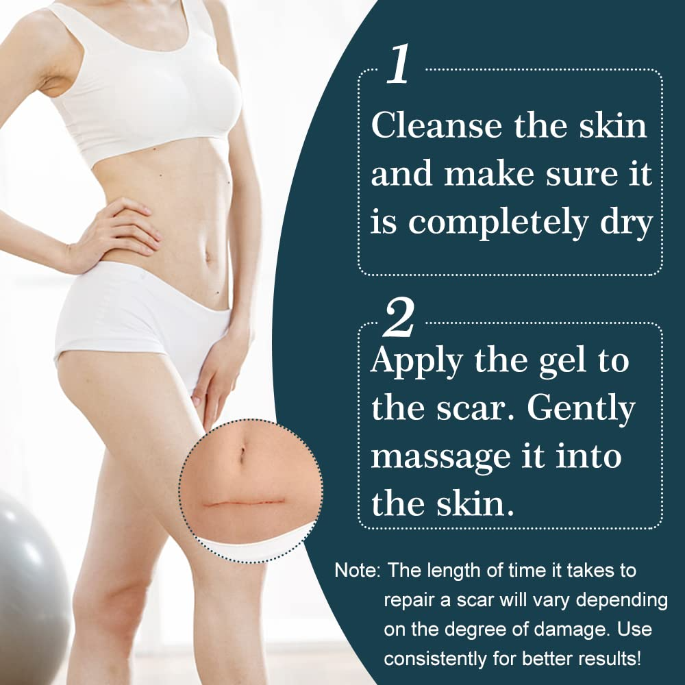 ScarRelief™ – Beruhigen, Heilen und Haut sichtbar sanft regenerieren und erneuern [1 + 1 Gratis]