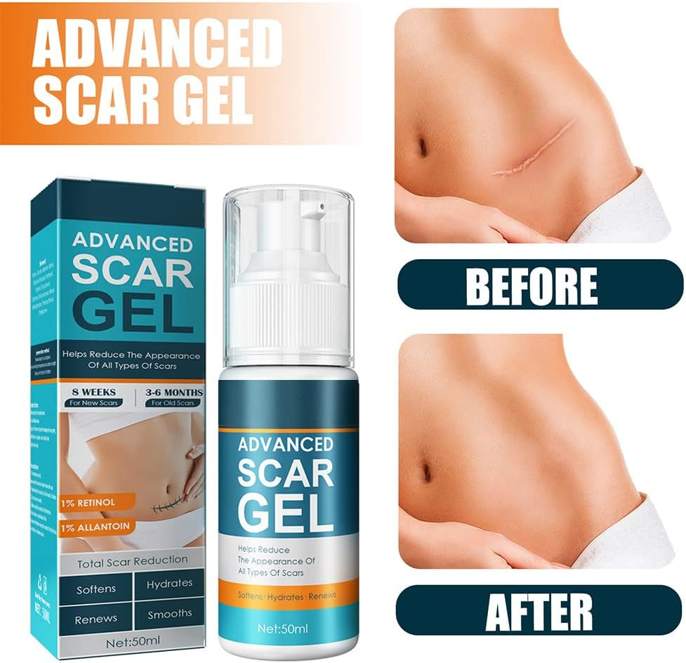 ScarRelief™ – Beruhigen, Heilen und Haut sichtbar sanft regenerieren und erneuern [1 + 1 Gratis]