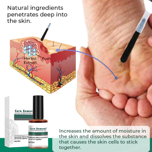 CallusClear™ – Hühneraugen- und Hornhautentferner mit extra starkem Linderungsgel [1 + 1 Gratis]