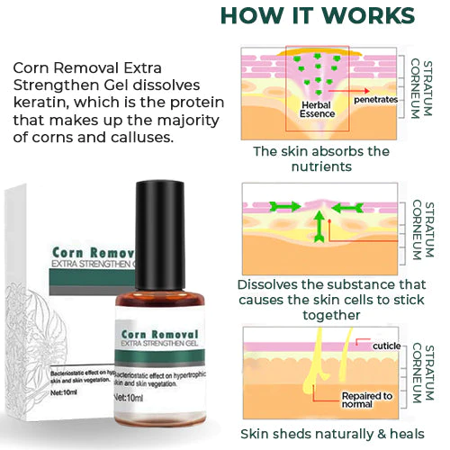 CallusClear™ – Hühneraugen- & Hornhautentferner mit extra starkem Linderungsgel [1 + 1 Gratis]
