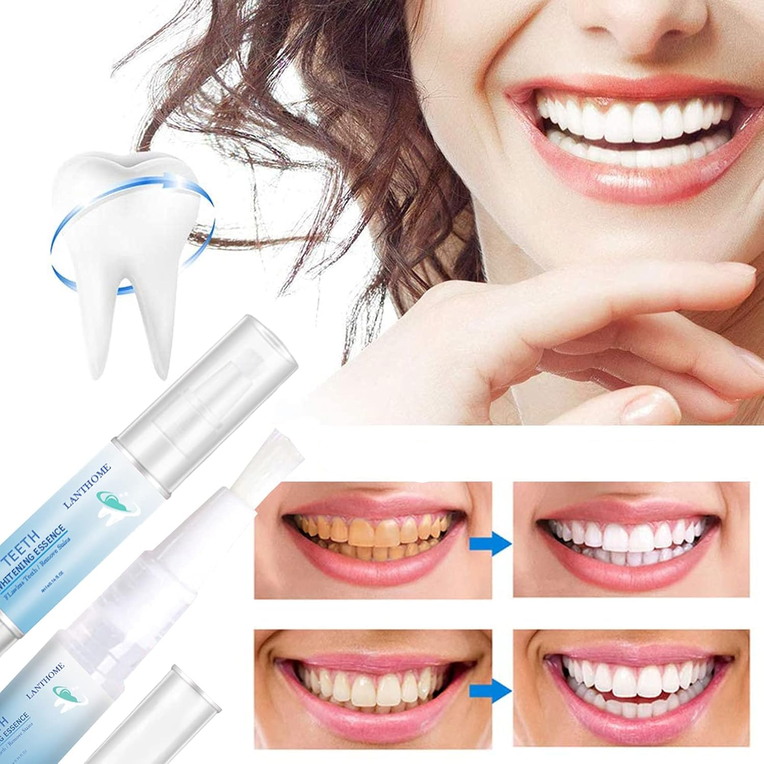 1 + 1 Gratis | UltraWhite™ - Zahnaufhellungs-Essenz [Letzter Tag Rabatt]