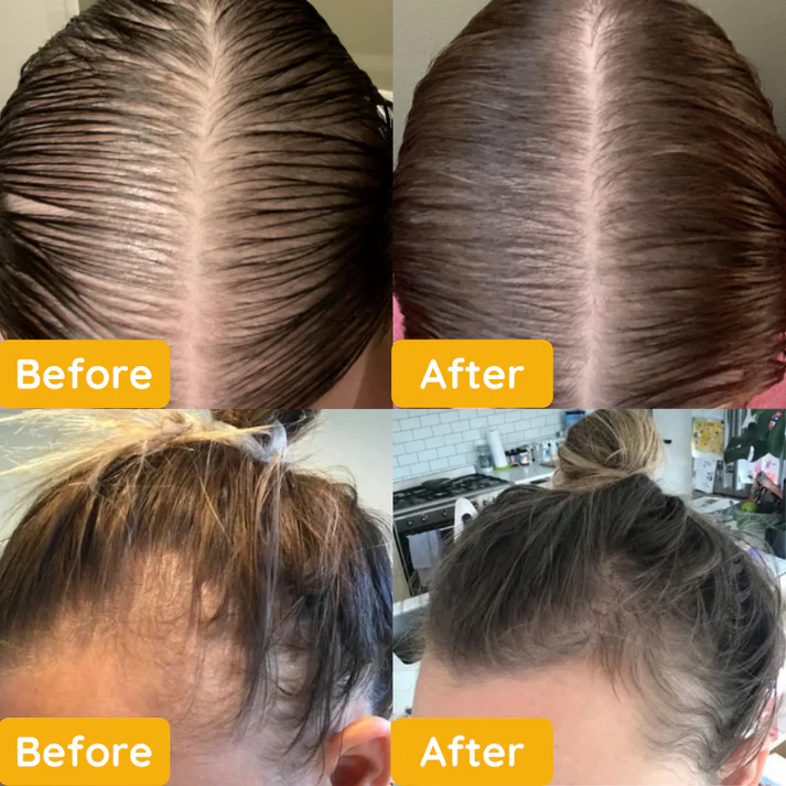 Jairy™ - Ätherisches Öl für das Haarwachstum [1 + 1 Gratis]