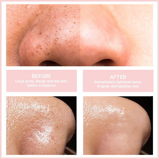 GlowPure™ – Sanftes Gesichtsreinigungsgerät für strahlende, gepflegte Haut [50% Rabatt]