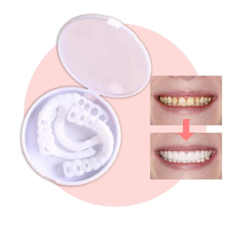 SmileSnap™ – Einrastende Veneers für ein Perfektes Lächeln | 1 + 1 Gratis