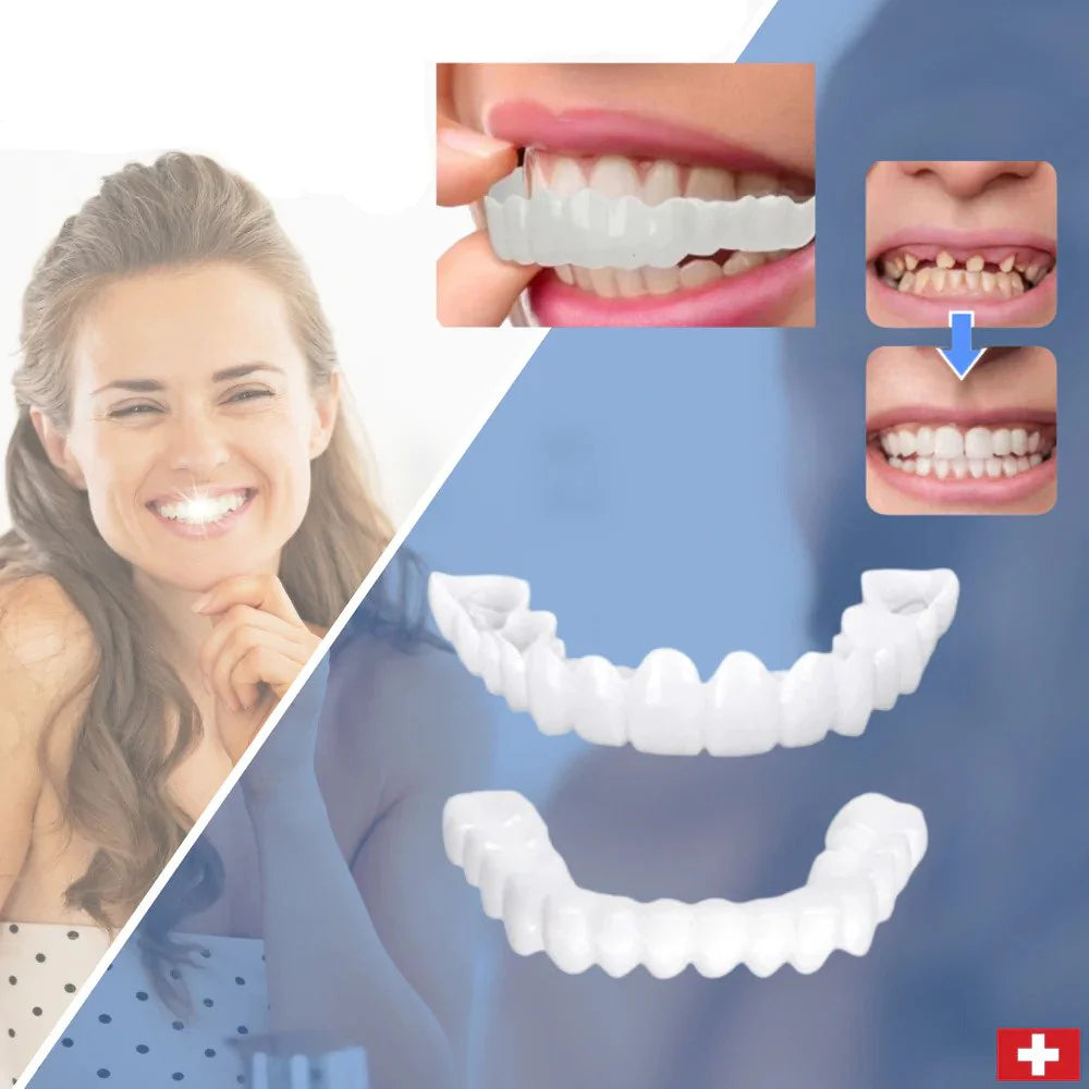 SmileSnap™ – Einrastende Veneers für ein Perfektes Lächeln | 1 + 1 Gratis