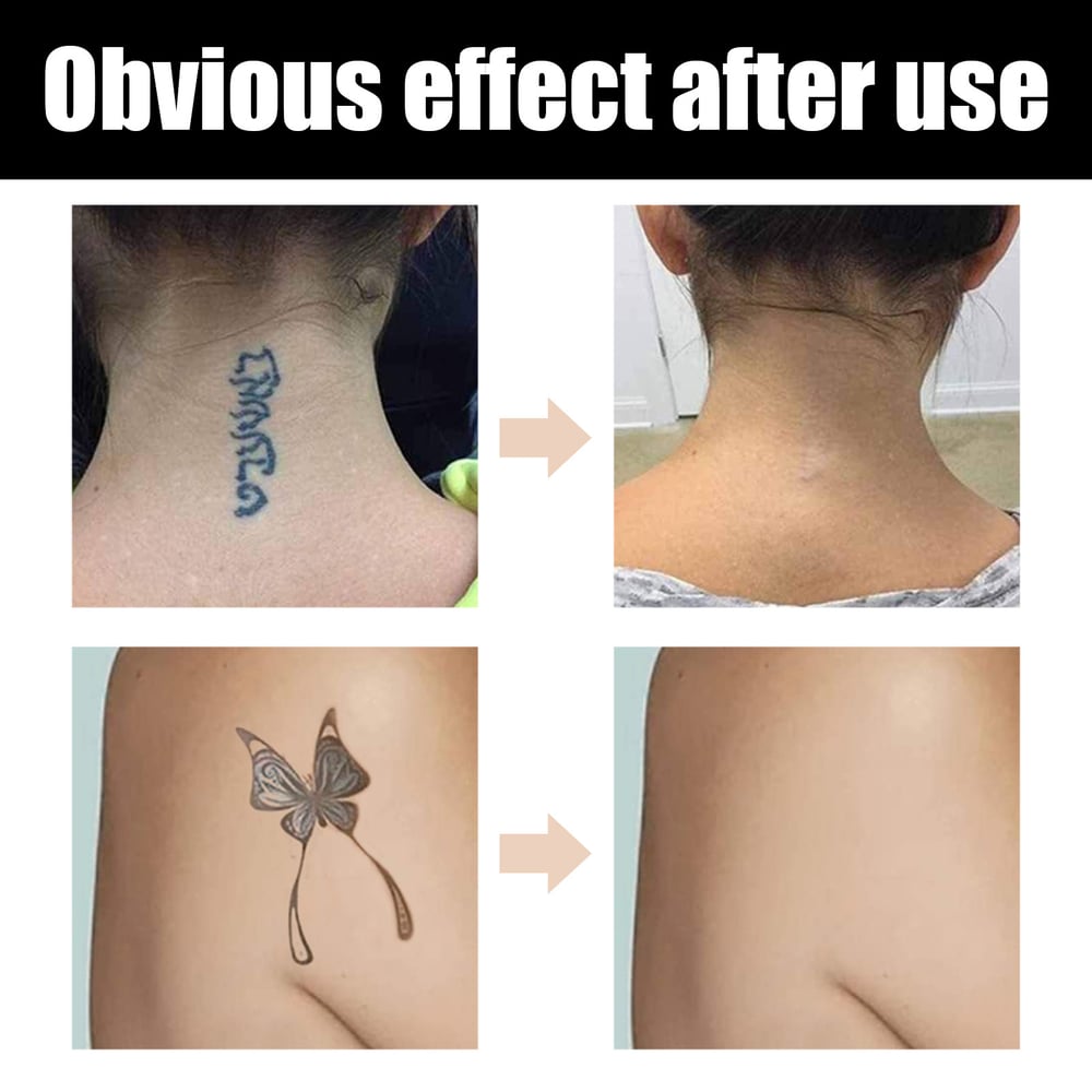 DermaVeil™ – Wasserfeste Abdeckung für Tattoos & Narben mit natürlichem Finish [1 + 1 Gratis]