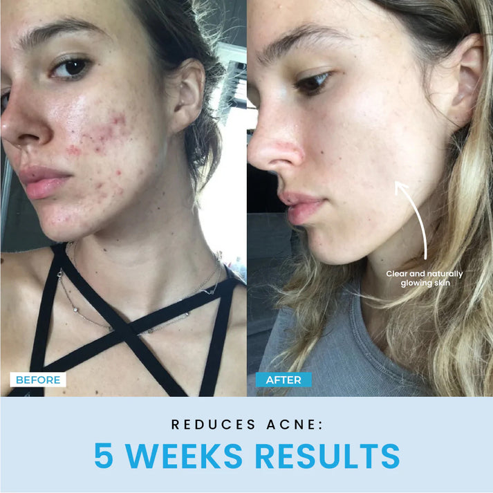 ContourVive EMS Gesichtsstraffungsgerät – Kieferlinie, LED-Therapie, Hautlifting, Anti-Aging, Mikrostrom