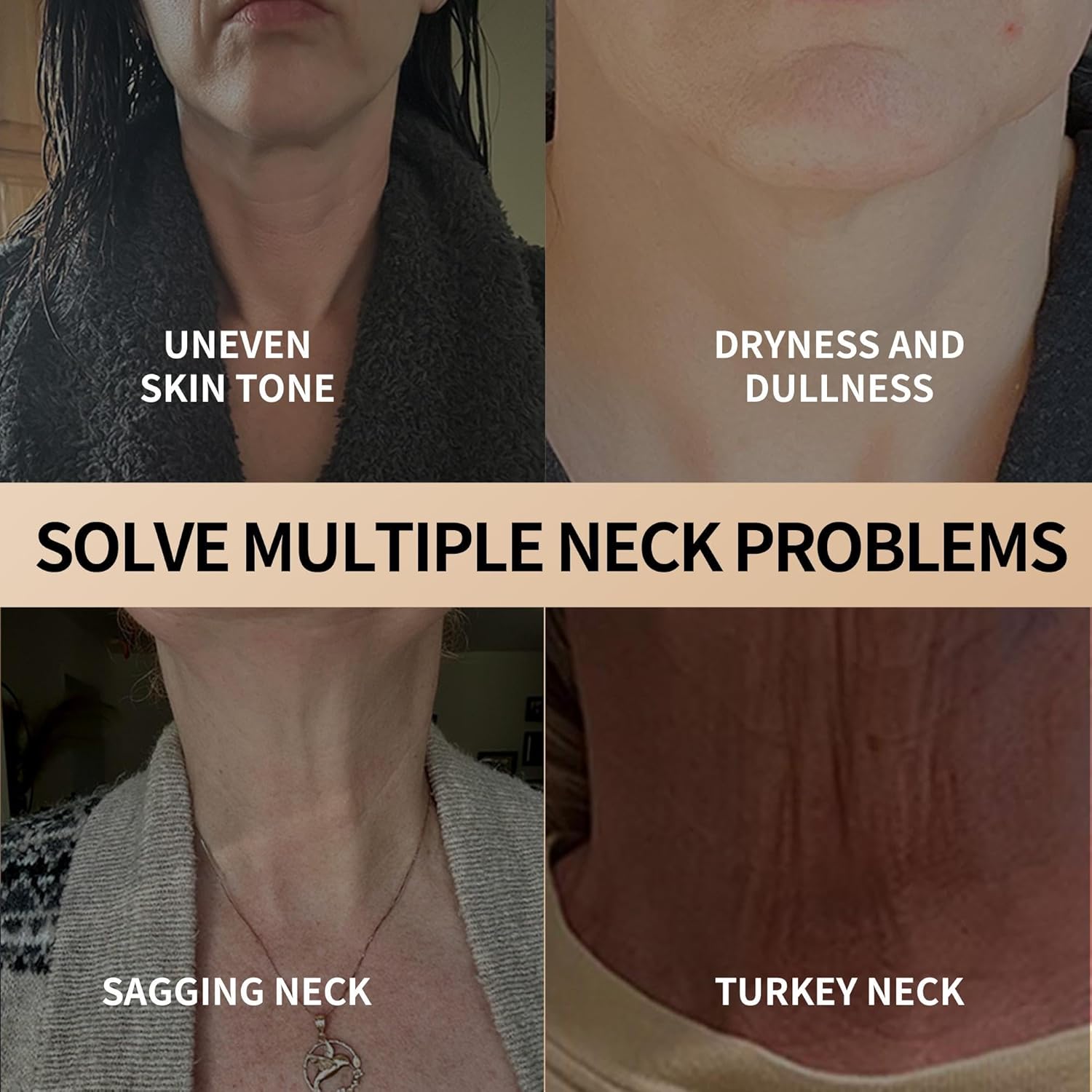 NeckLuxe™ - Erzielen Sie ein festeres, definierteres Dekolleté! [1 + 1 Gratis]