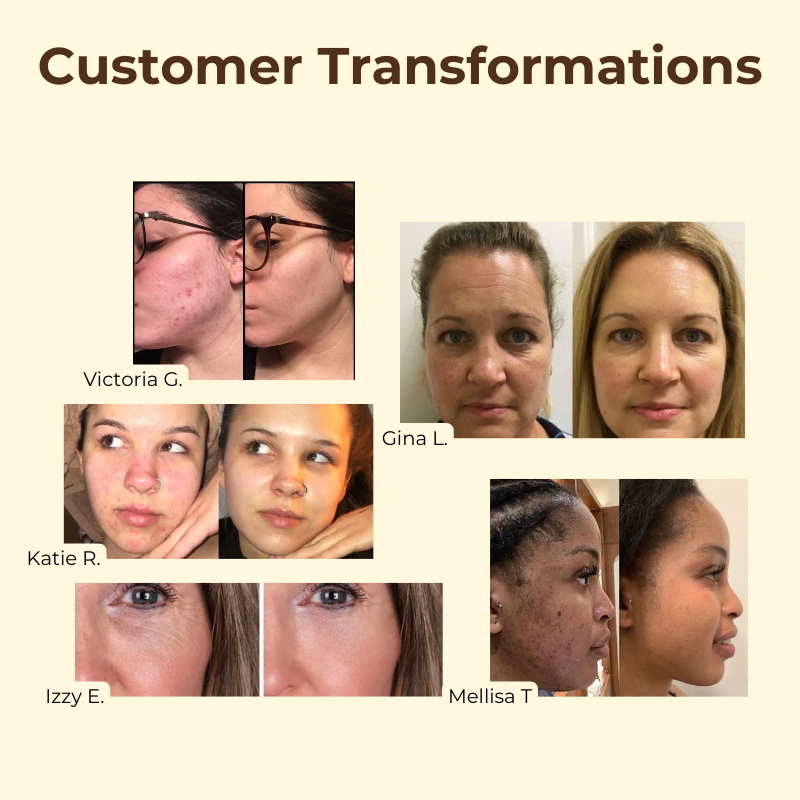 TeaElixir™ – Schwarzer Tee Gesichtsmaske für strahlende, straffe & porentief gereinigte Haut [1 + 1 Gratis]