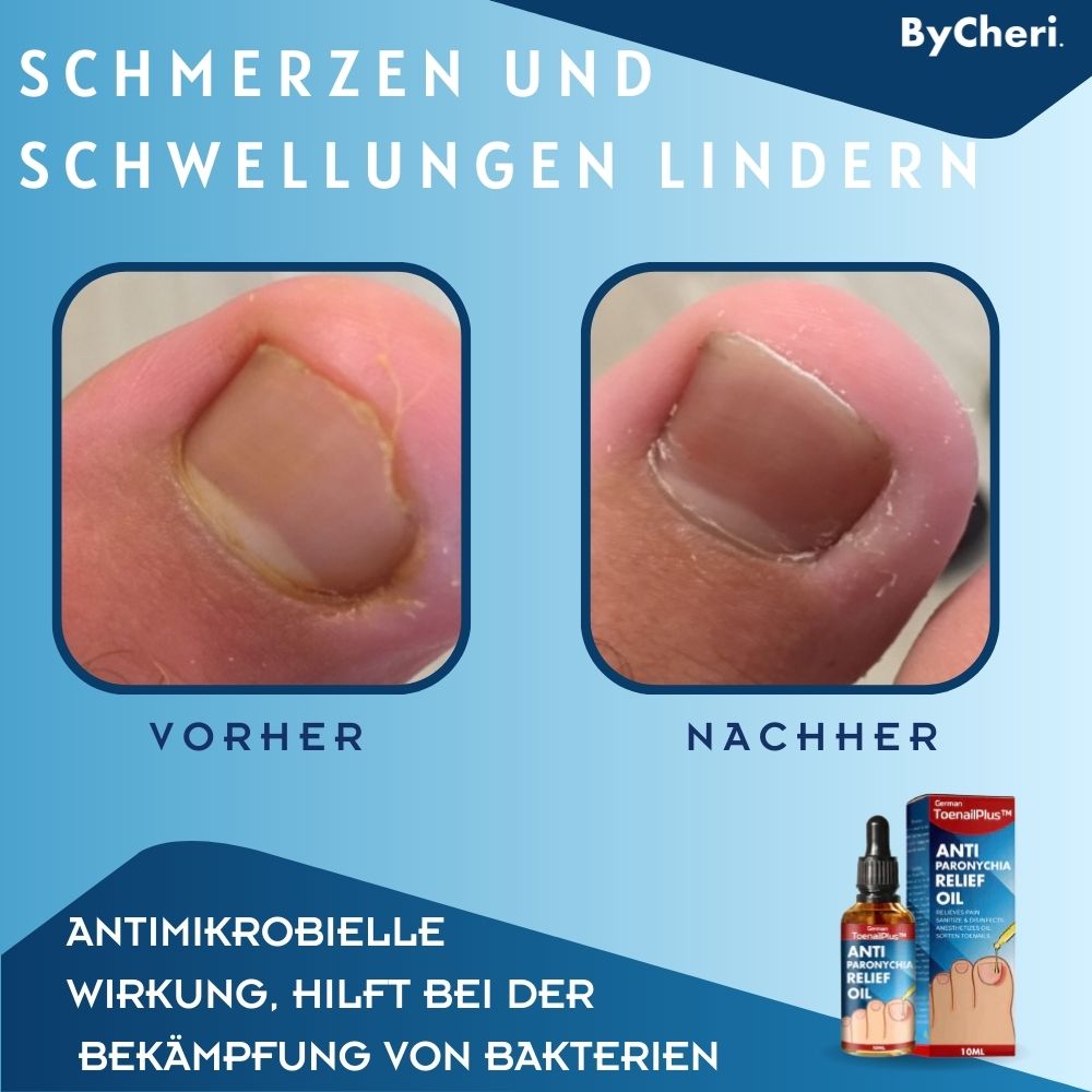 HeilungsTropfen™ - Beschädigte Nägel in 4 Wochen wiederherstellen [1 + 1 Gratis]