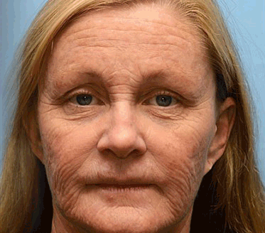 FirmTouch™ – Glättende Hautpflege, Faltenreduktion & intensive Feuchtigkeit [1 + 1 Gratis]