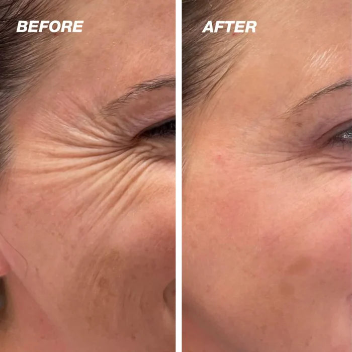 Skinmend™ – Narbenbehandlungstücher für Strahlende Haut | 1 + 1 Gratis