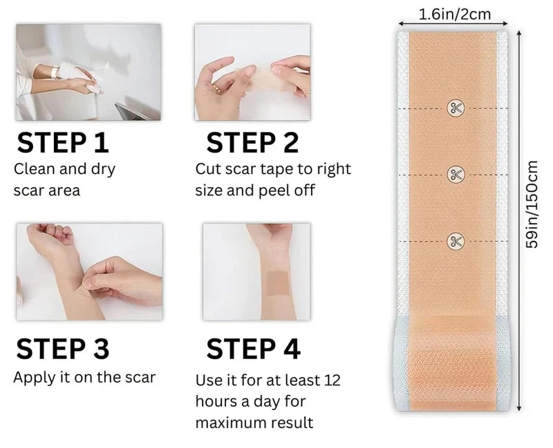 Skinmend™ – Narbenbehandlungstücher für Strahlende Haut | 1 + 1 Gratis