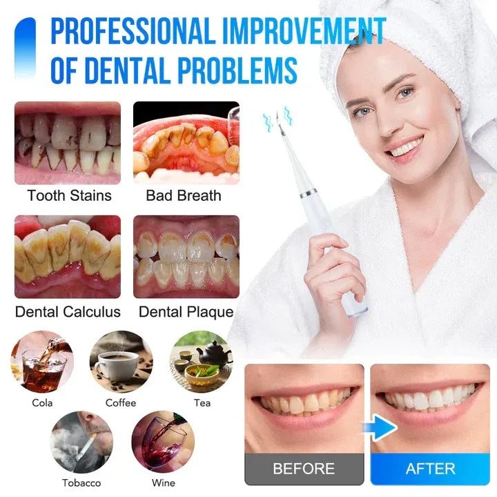 ToothCleaner™ – Wirksame Pflege für strahlend gesunde Zähne! [50 % Rabatt]
