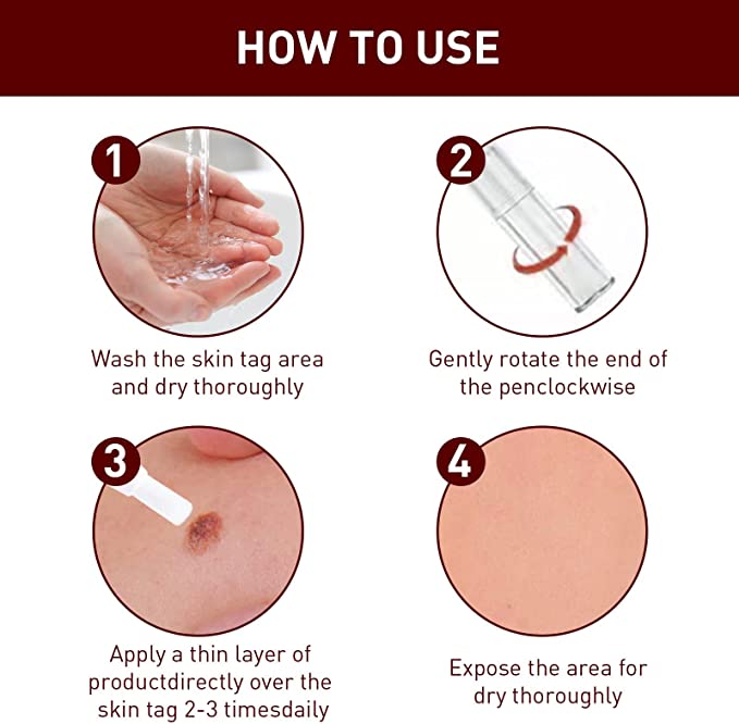 WipeOff Remover – Hautanhängsel & Warzen sanft und narbenfrei entfernen