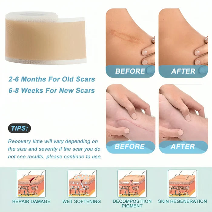 Skinmend™ – Narbenbehandlungstücher für Strahlende Haut | 1 + 1 Gratis