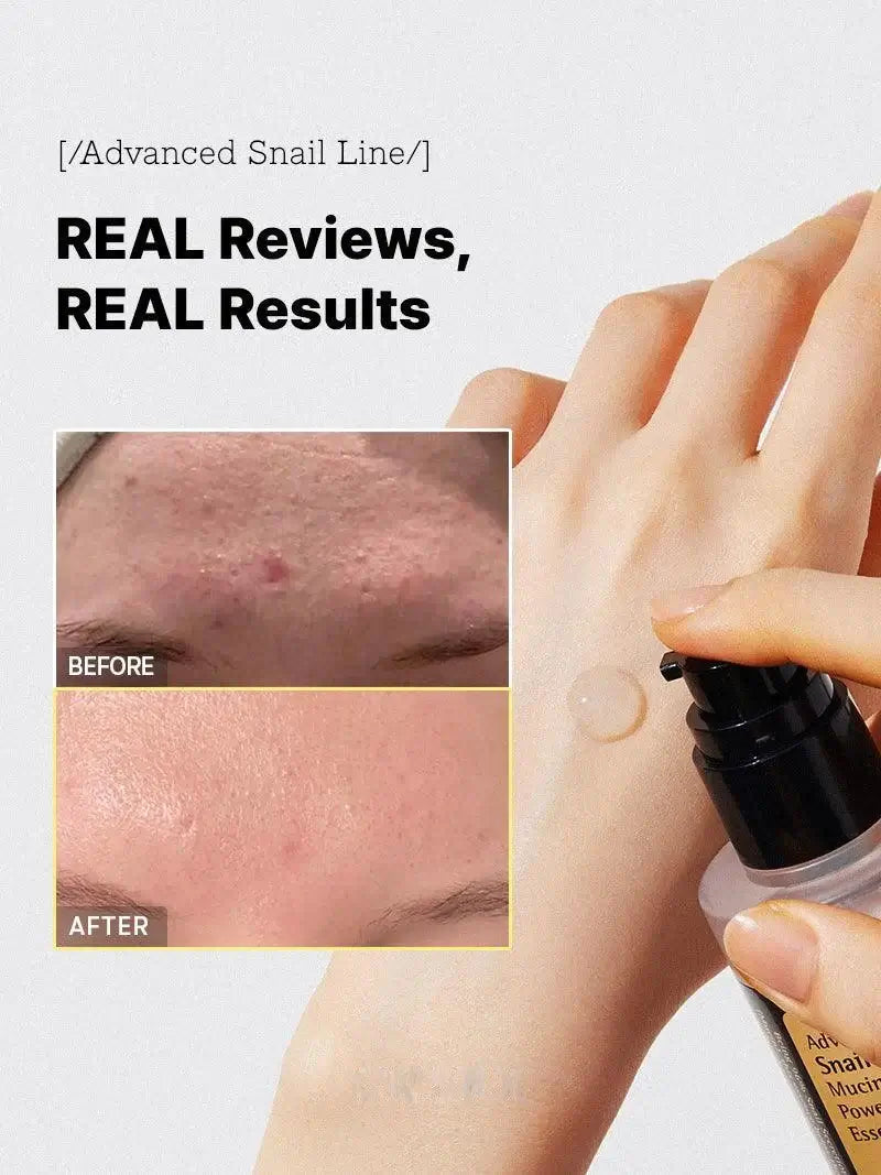 GlowFace™ – 96,3 % Schneckenschleim, Hautregeneration & intensive Feuchtigkeit [50% Rabatt]