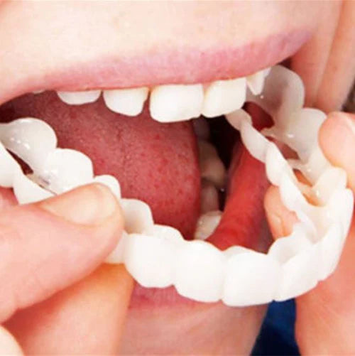 SmileSnap™ – Einrastende Veneers für ein Perfektes Lächeln | 1 + 1 Gratis