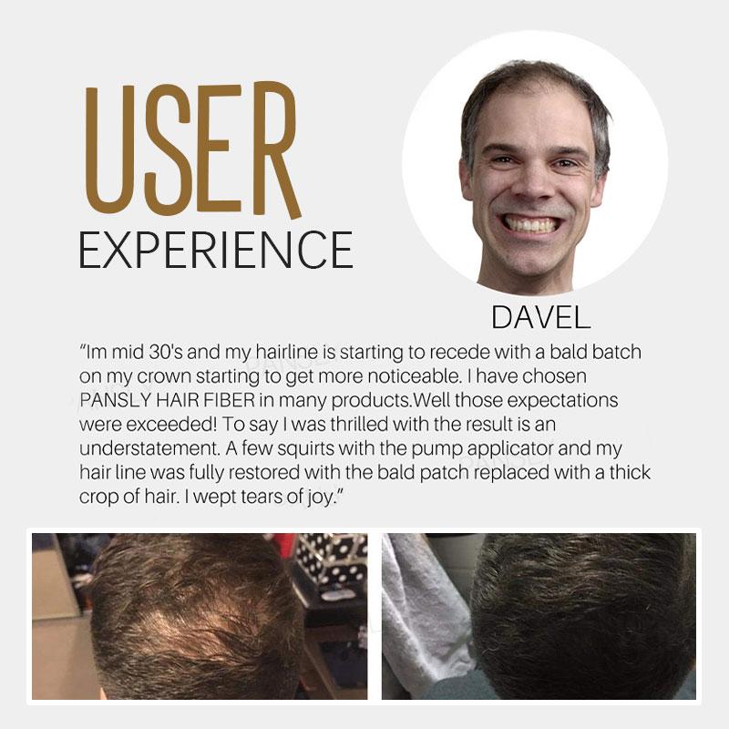 ThickLocks™ - Haarfaserpulver Für Sofortiges Volumen Und Fülle [1 + 1 Gratis]