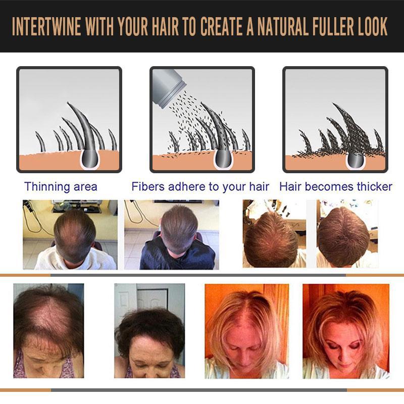 ThickLocks™ - Sofort volleres Haar [1 + 1 Gratis]