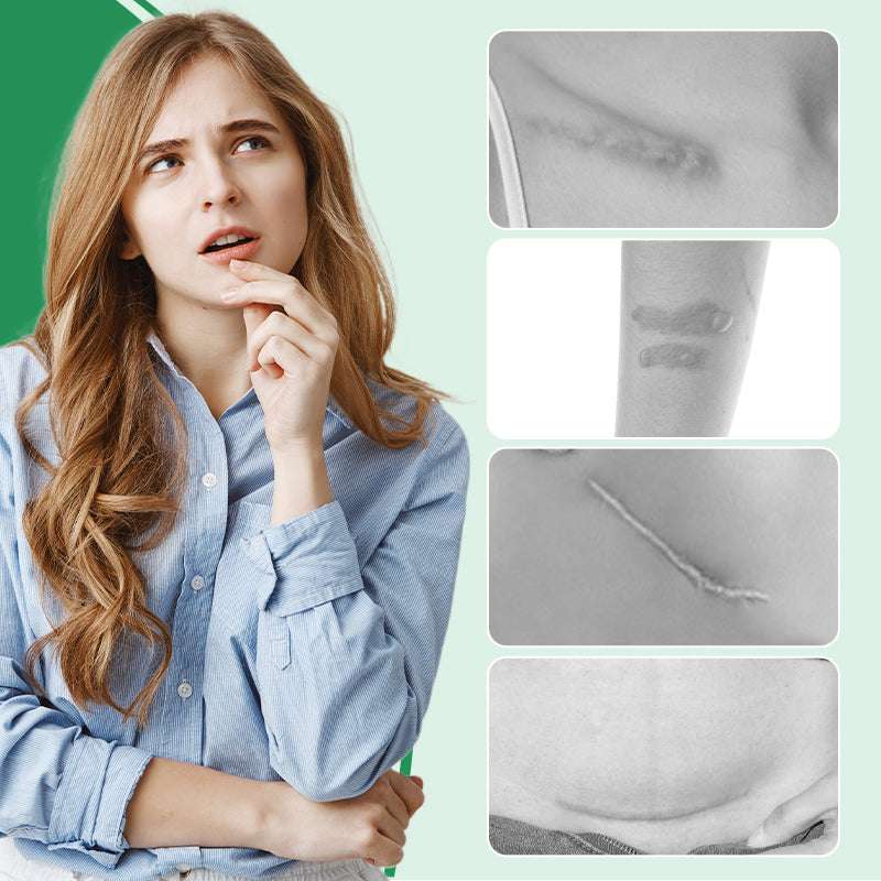 Scarify™ – Wiederverwendbare Silikon-Littekenspreizer für sanfte Narbenpflege [1 + 1 Gratis]