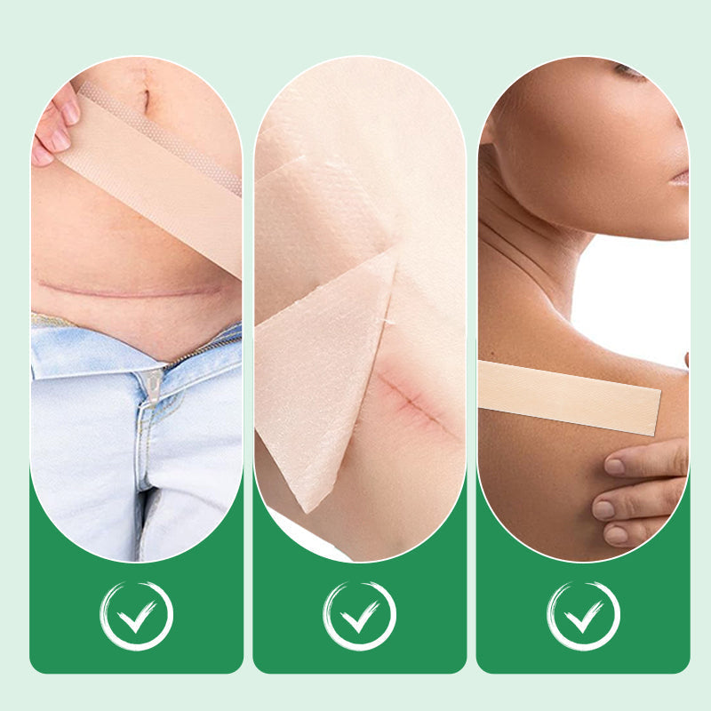 Scarify™ – Wiederverwendbare Silikon-Littekenspflaster für glatte, makellose Haut [1 + 1 Gratis]