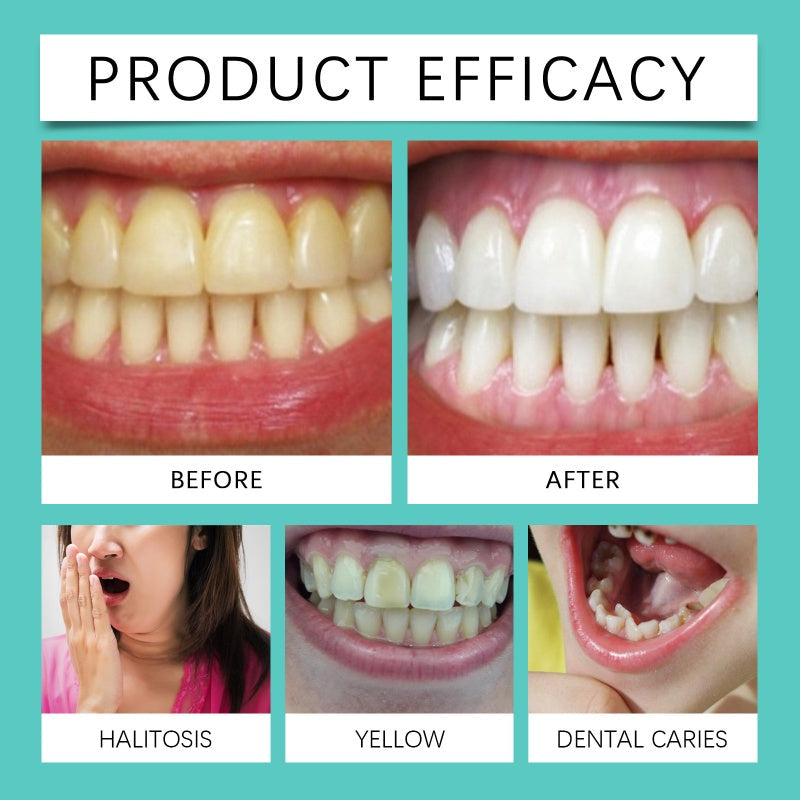 SmileBright Whitening Strips – Zahnschmelzschonende Teeth Whitening Streifen für Weiße Zähne