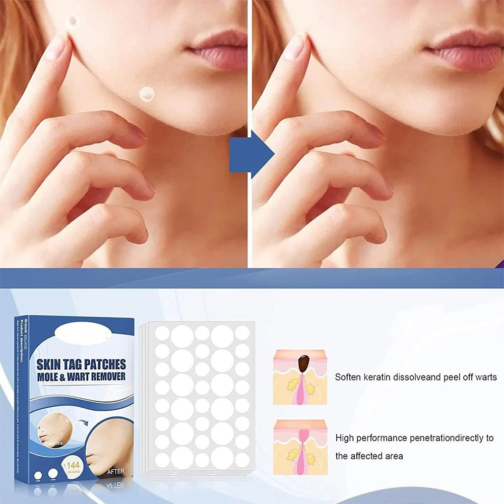 SkinPatch™ – Schmerzfreie, nicht-invasive Behandlung für sichtbar klare, gesunde Haut [1 + 1 Gratis]