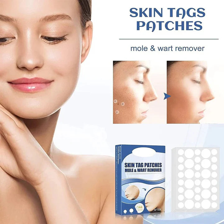 TagAway™ – Pflaster zur Entfernung von Hautanhängern und Warzen | 50% Rabatt