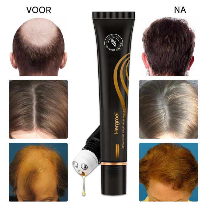 Follicyn™ - Bio-Haarserum Roller [1 + 1 Gratis]