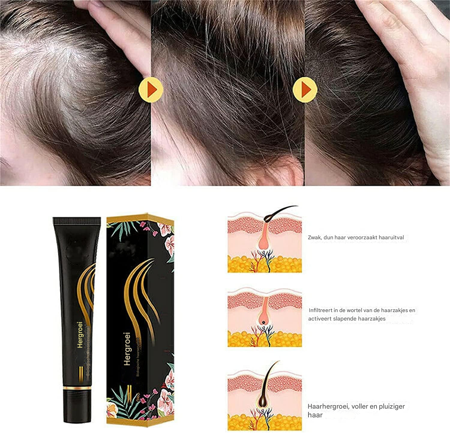 Follicyn™ - Bio-Haarserum Roller [1 + 1 Gratis]