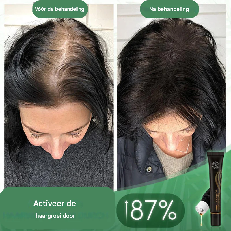Follicyn™ - Bio-Haarserum Roller [1 + 1 Gratis]