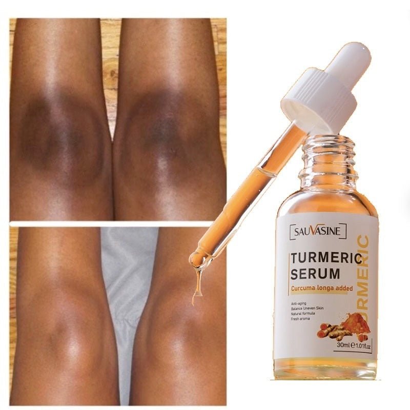 DunklerFleckFix™ - Strahlende Haut in ein paar Tagen [1 + 1 Gratis]